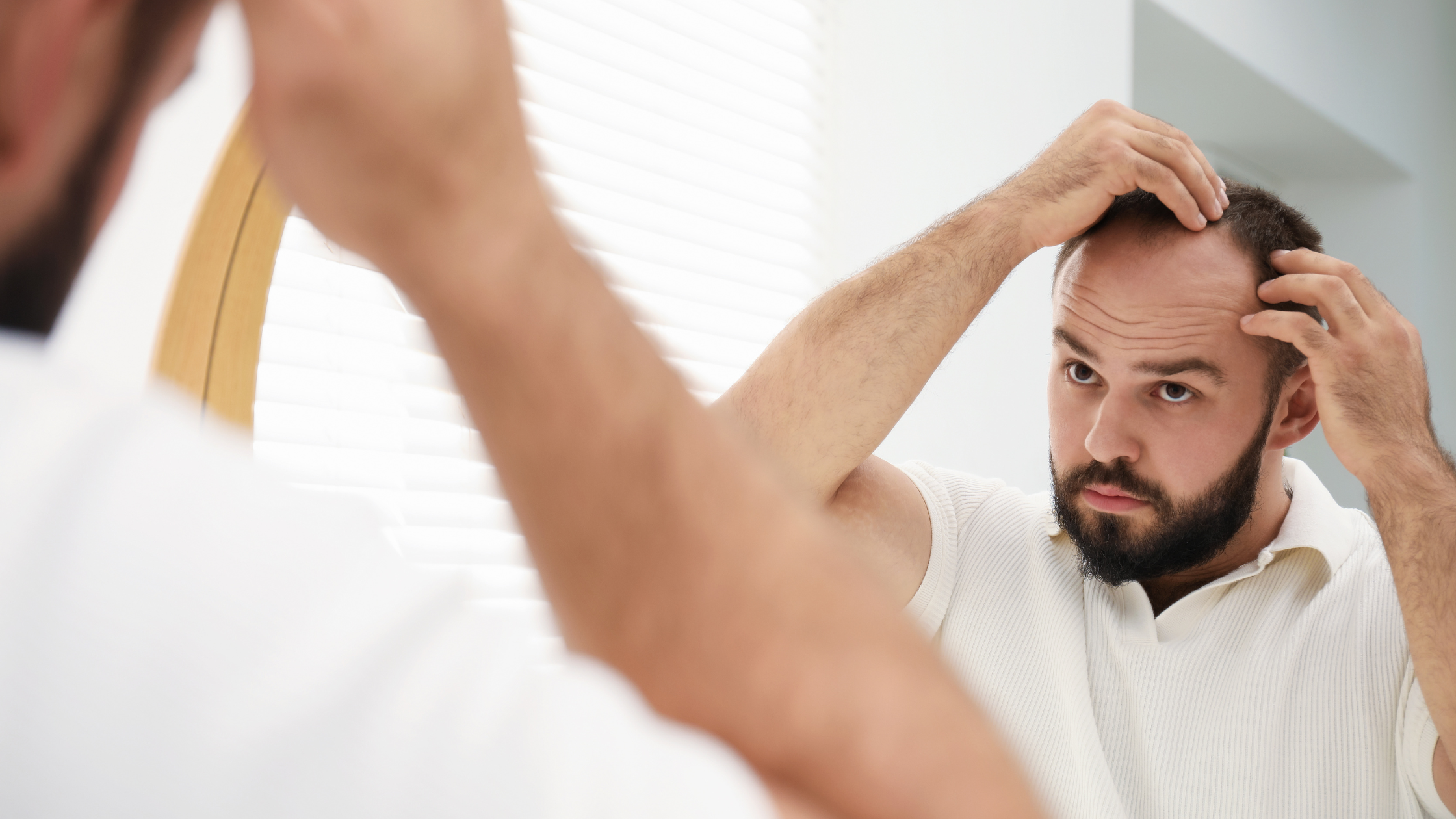 What’s Changed in Hair Restoration