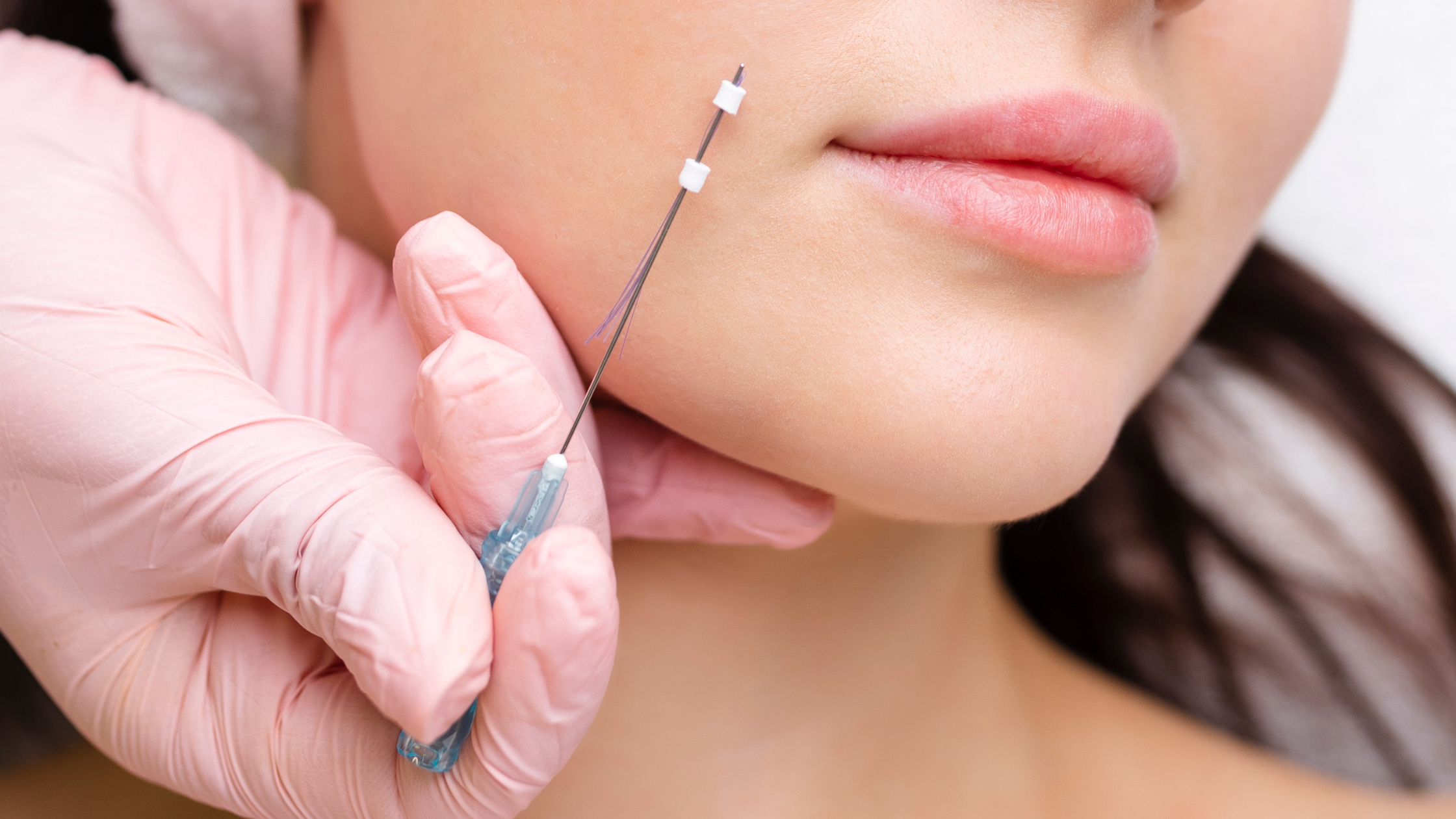 Indianapolis injector performing a thread lift.