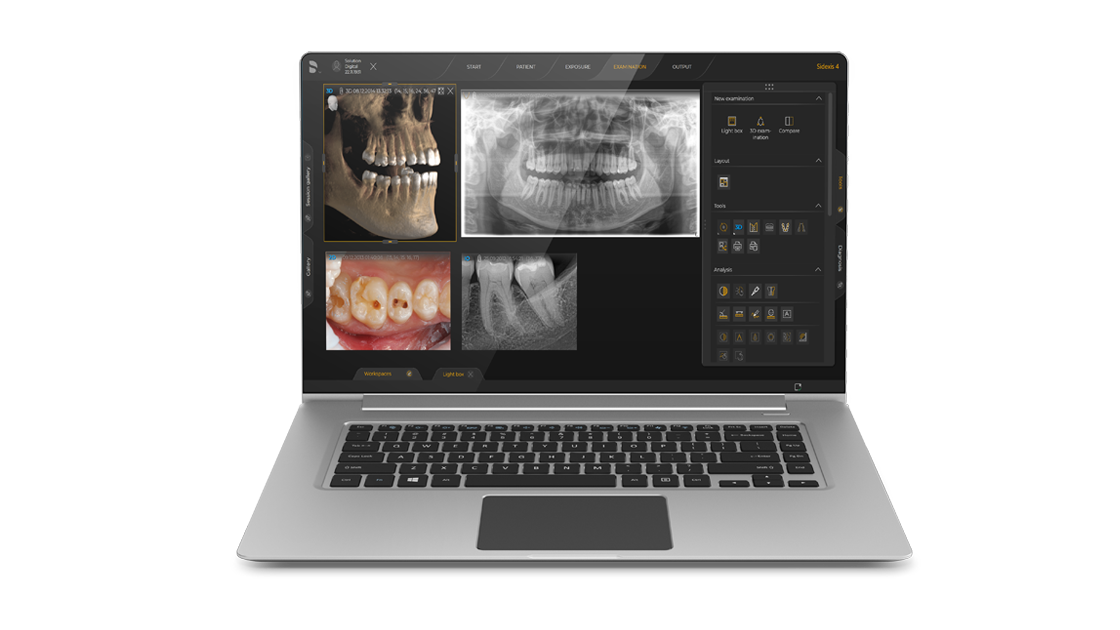Laptop screen displaying dental X-ray images, including panoramic and intraoral scans, with analysis tools around the images.