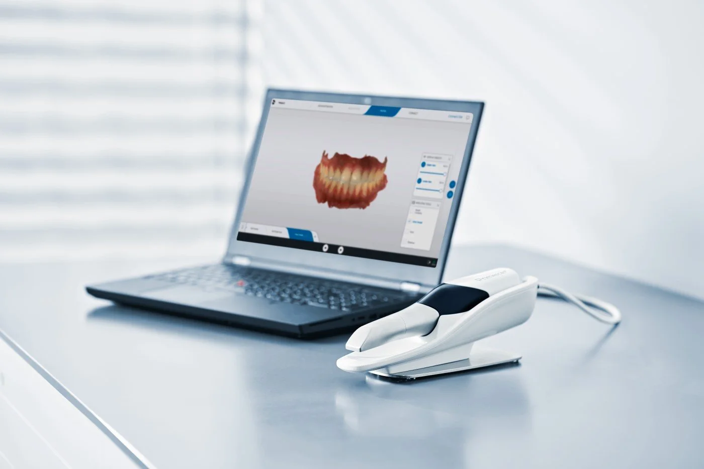 Laptop displaying a 3D model of a set of teeth. A dental scanner is connected to the laptop on a white table in a bright room.