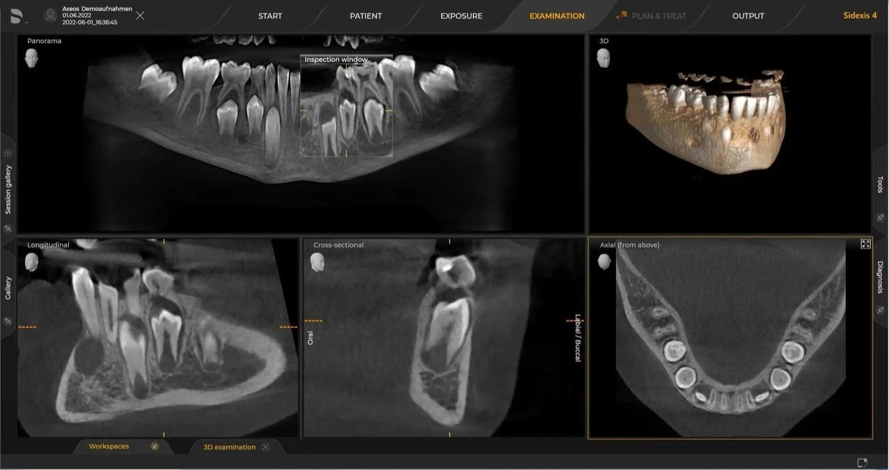 Benefits of CBCT Technology in Dental Imaging