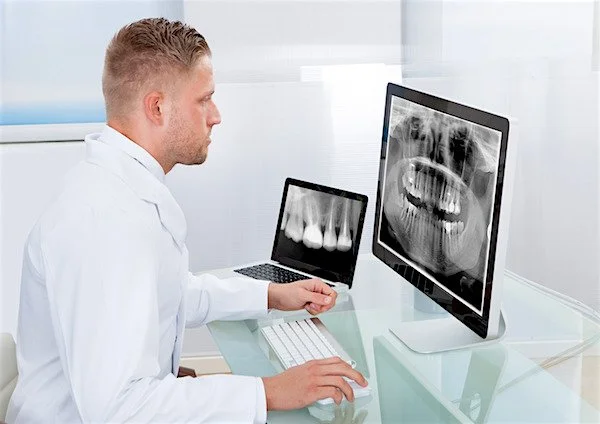 Dentist examining dental X-rays on computer screens in a modern office.