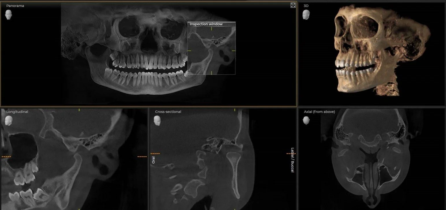 3D CBCT scan at New Standard Imaging in Birmingham, AL