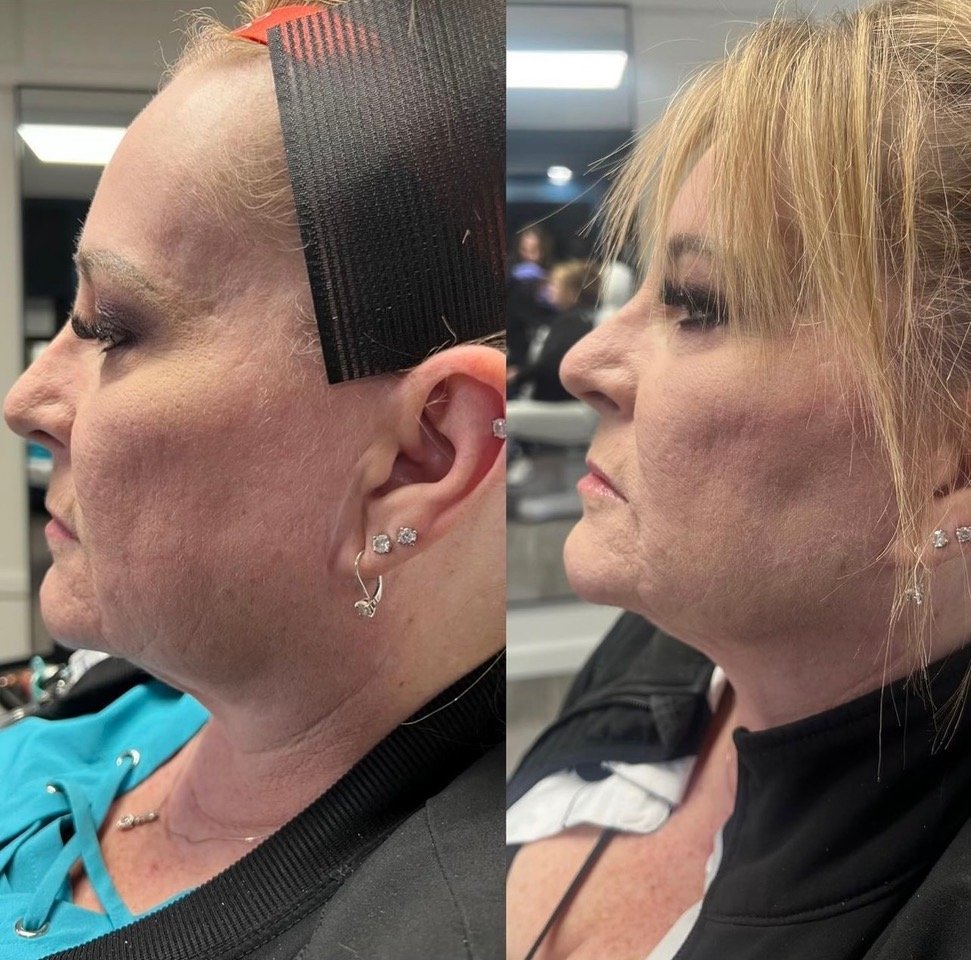 THREADS BEFORE & AFTER