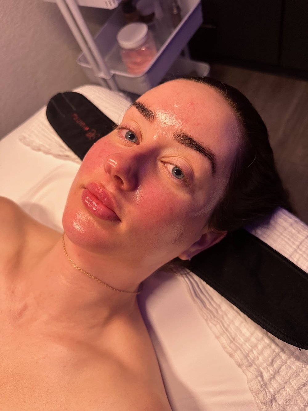 ENZYME FACIAL RESULTS