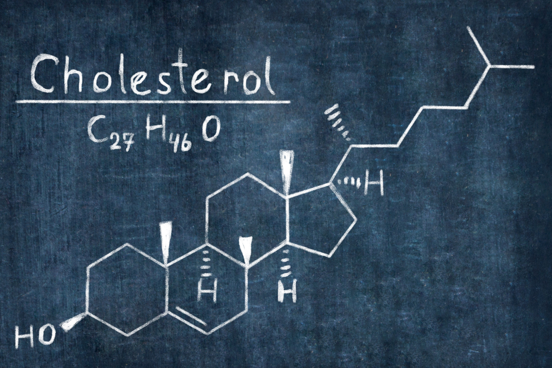 Lean Mass Hyper-Responders: One-Year Data That Could Shift the Cholesterol Paradigm
