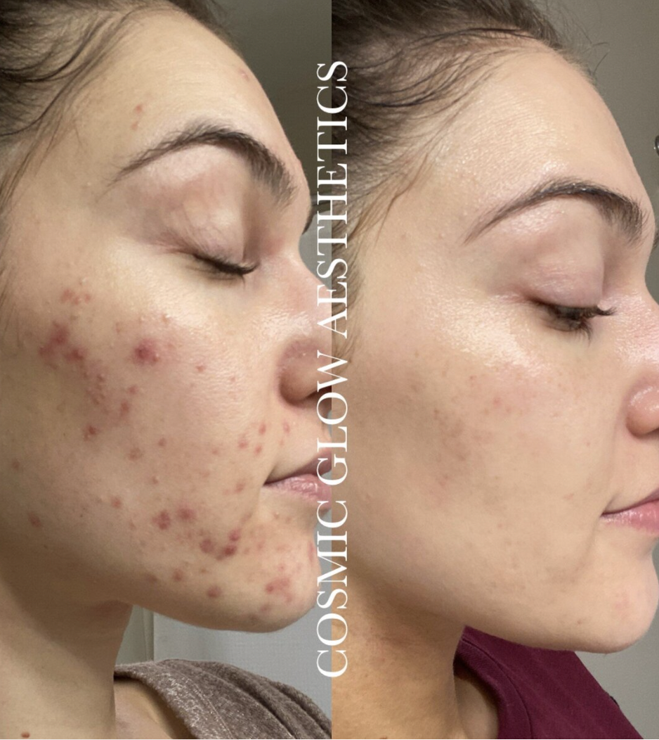 esthetician hershey pennsylvania