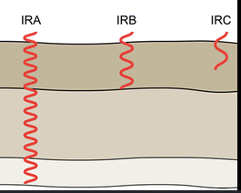 Diagram showing three types of electromagnetic radiation—IRA, IRB, and IRC—penetrating different layers of tissue.