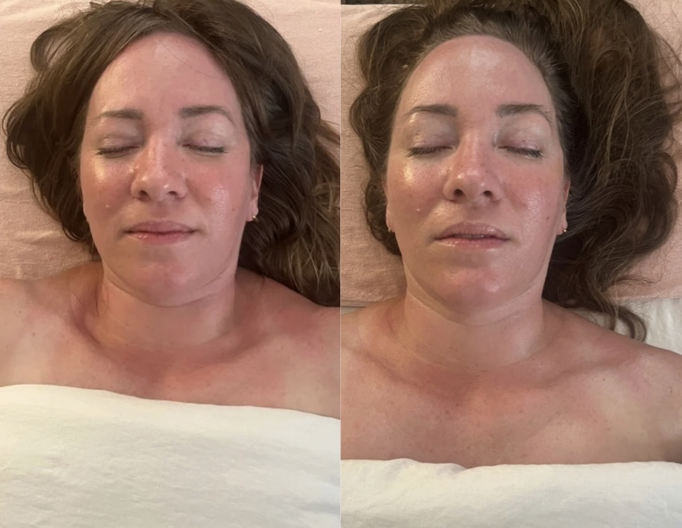 buccal-massage-portland