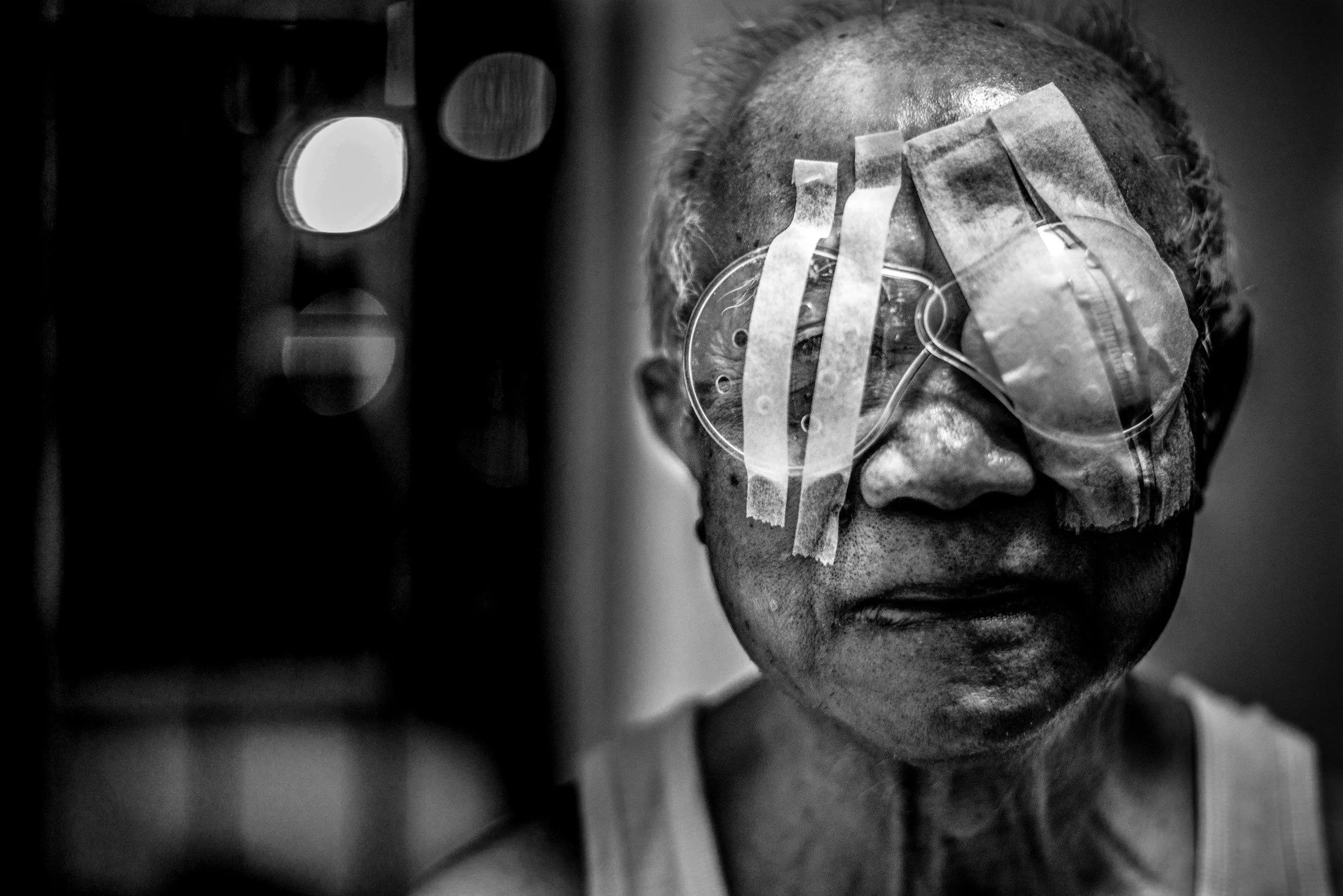 a person with bandages over his eyes