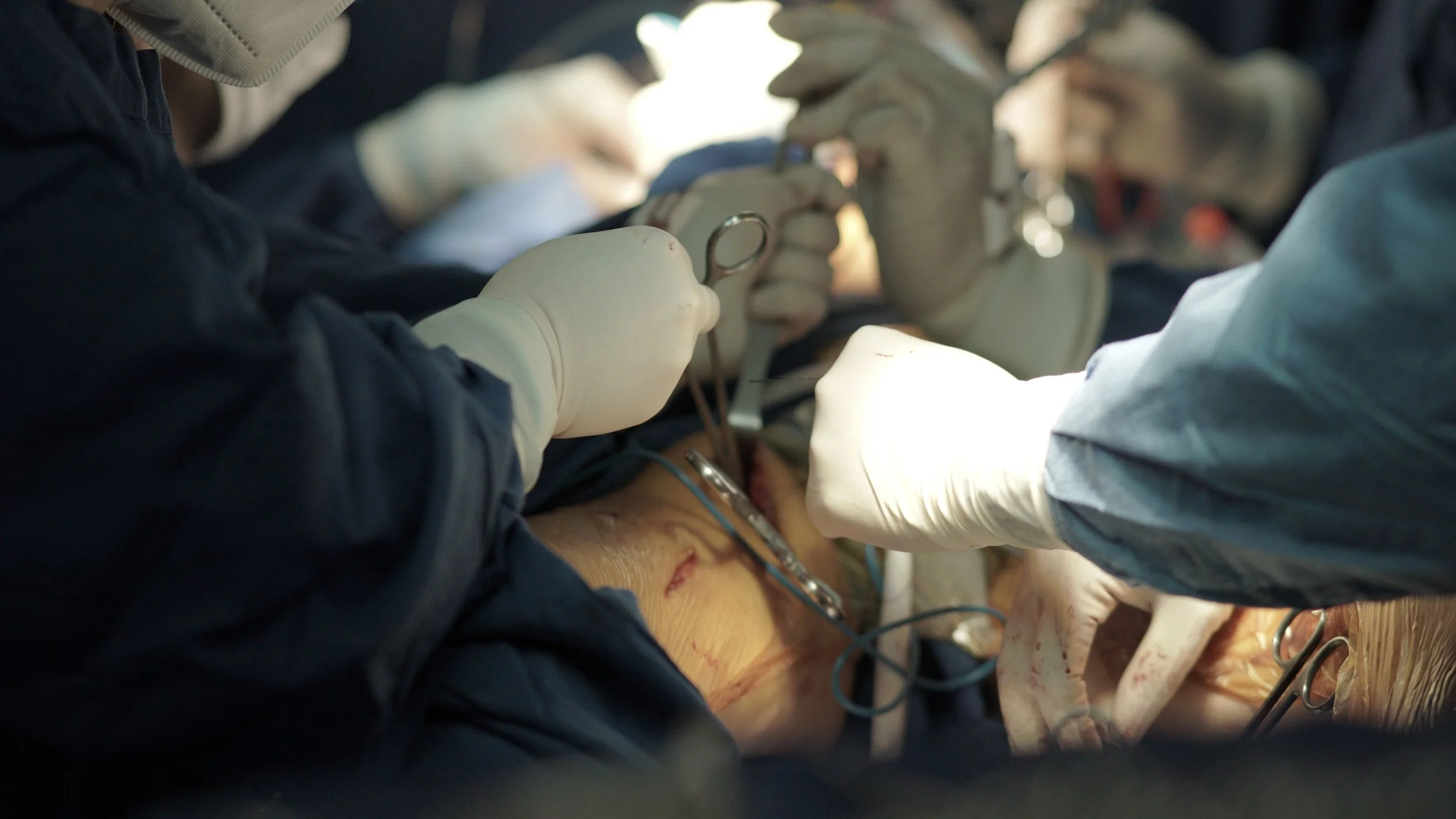 How to Maximize Your Workers' Compensation Settlement