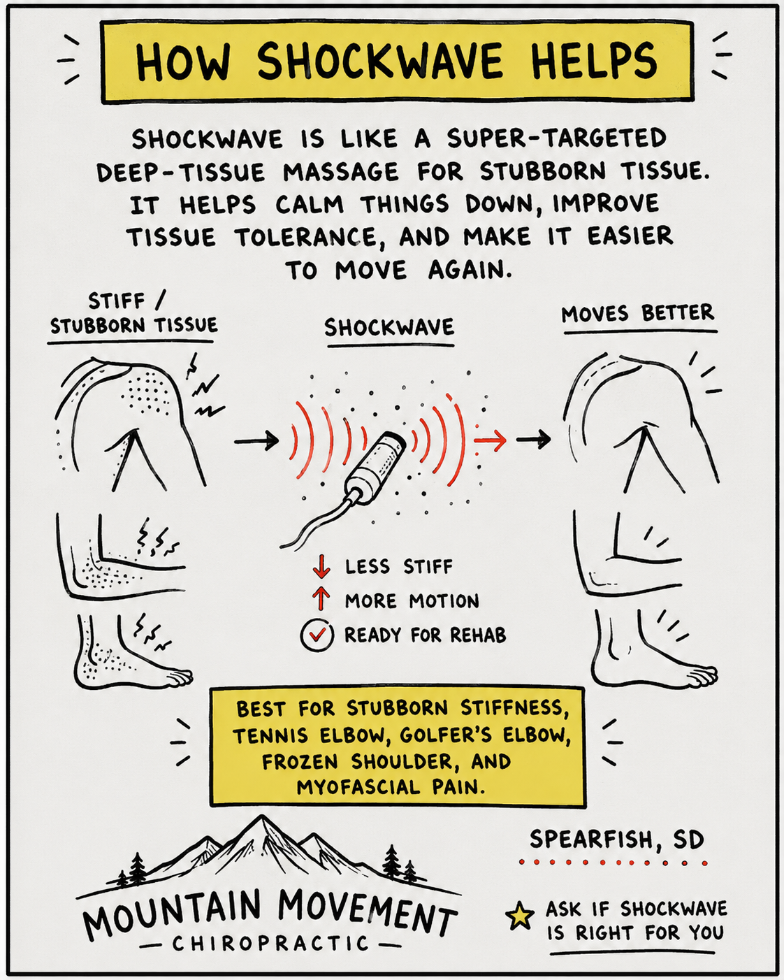 flyer showing how shockwave helps with patients conditions by Dr. Zach Hansen in Spearfish SD
