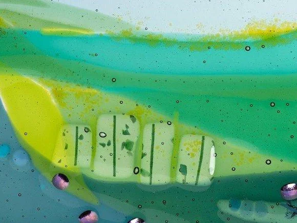 Sue King Art - Commissions - Healthcare - QE Hospital, South London