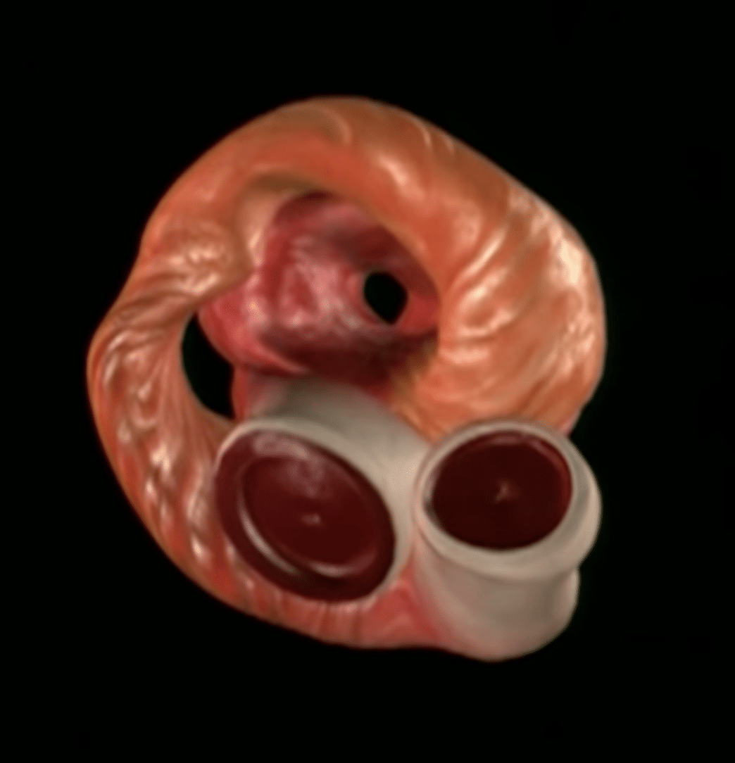 Axial Plane of the heart