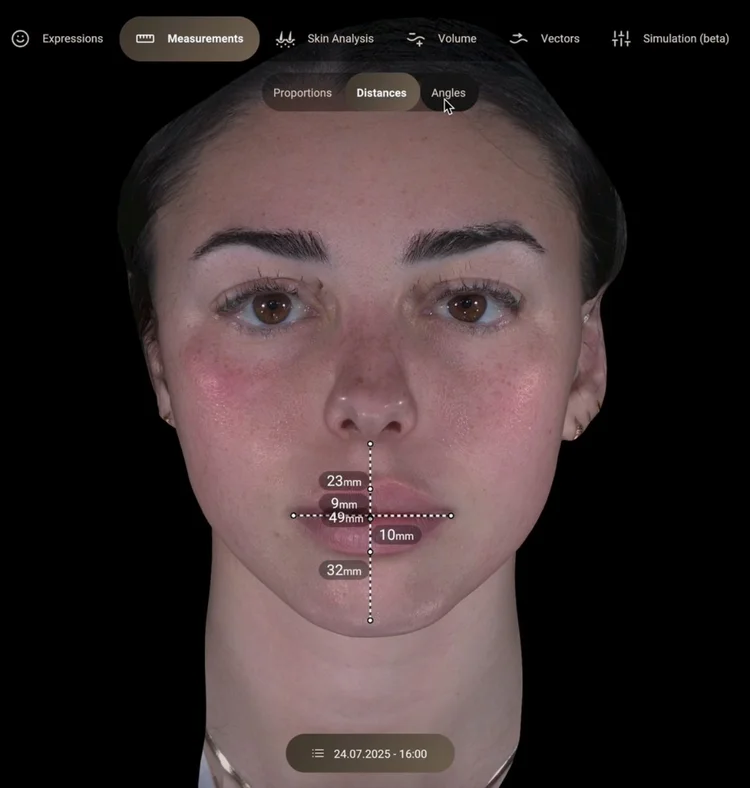 Facial feature distance measurements from 3D imaging