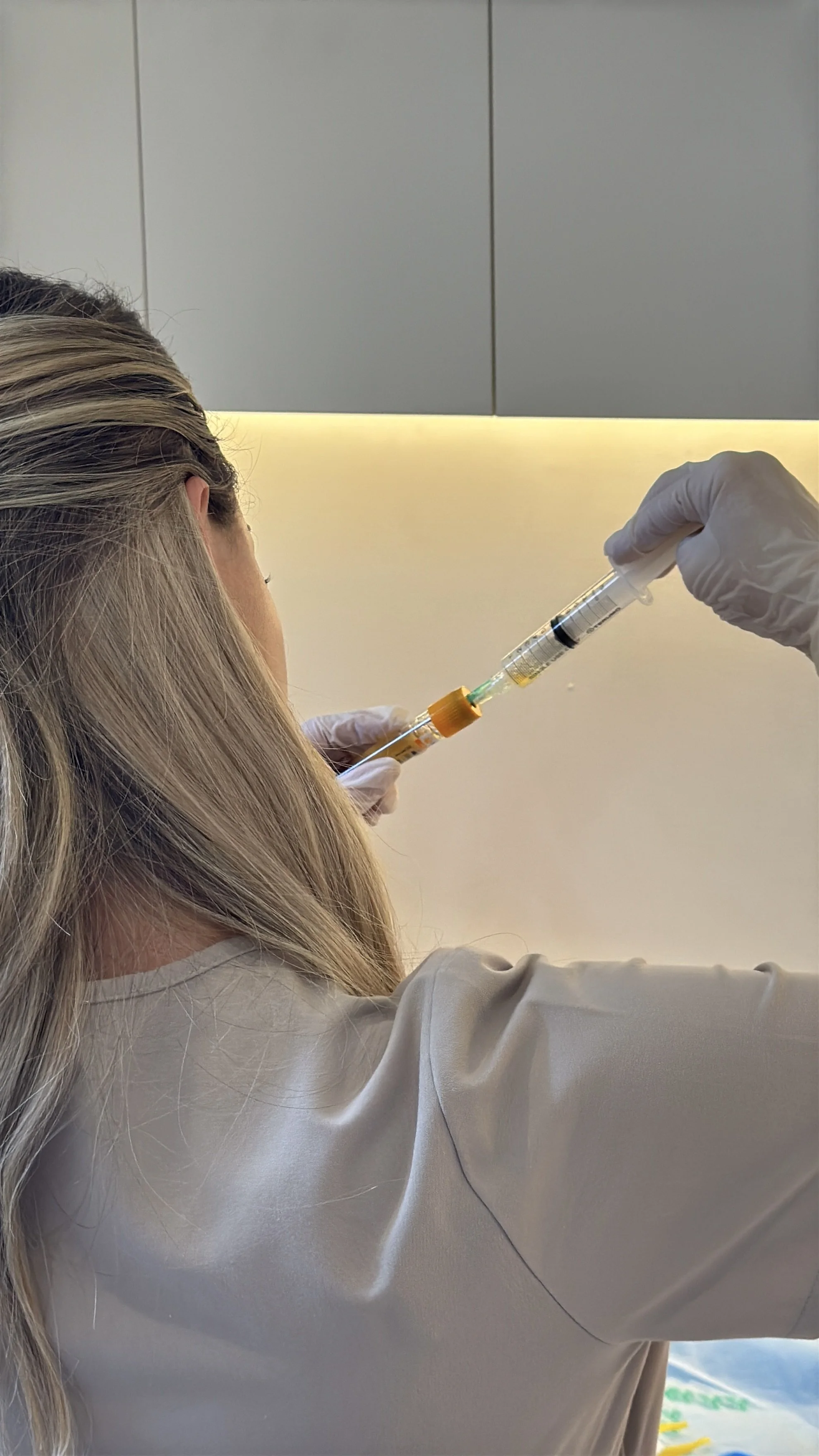 Collagen stimulation treatment at BYGOLDEN Parkdale Melbourne