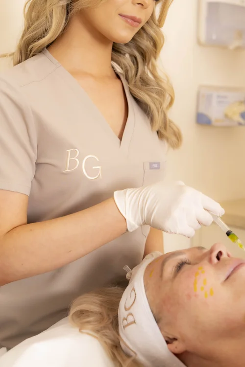 Chemical peel treatment at BYGOLDEN Melbourne
