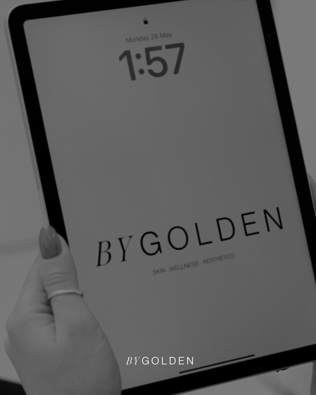 What to expect at BYGOLDEN cosmetic and skin clinic in Parkdale, Melbourne