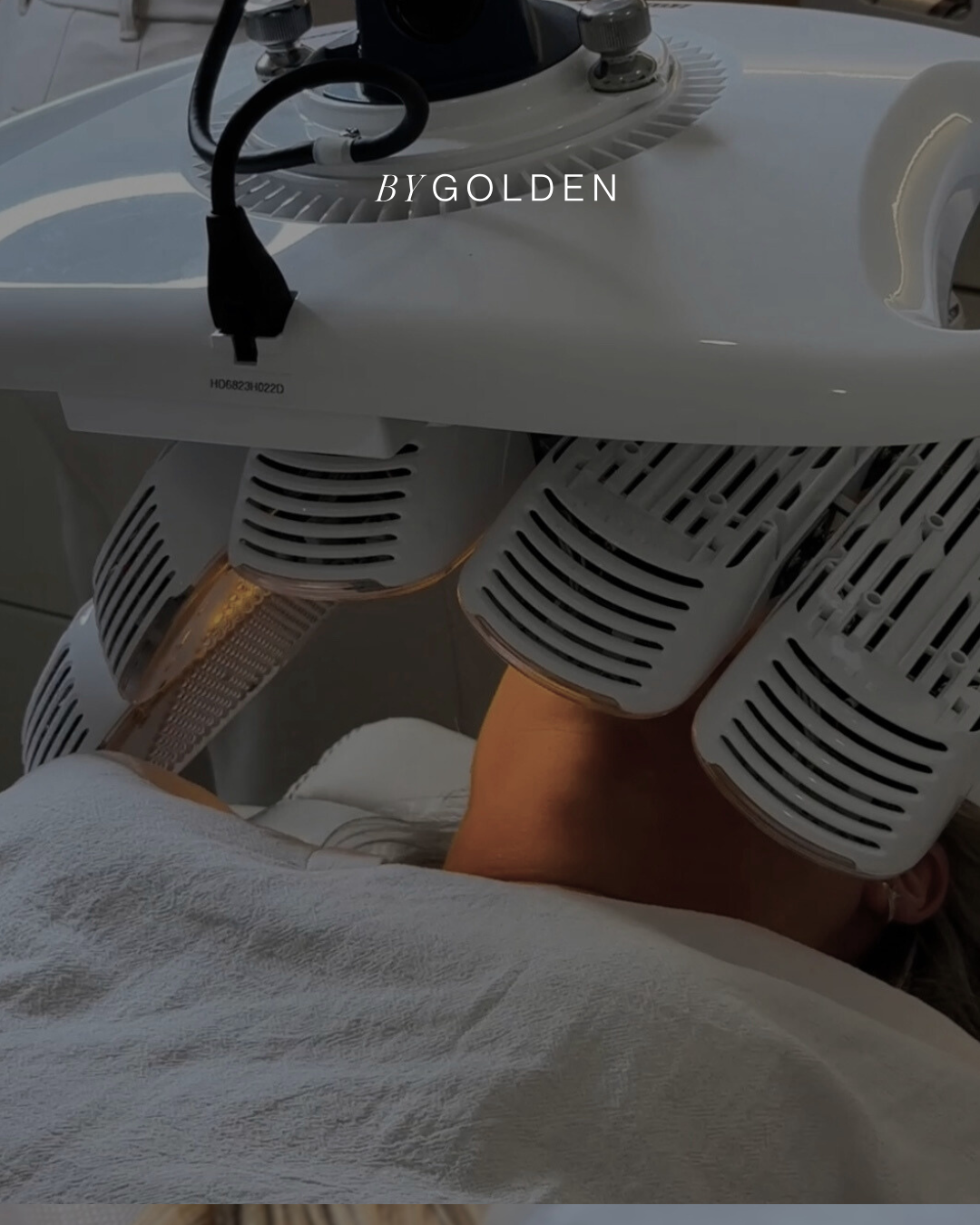 Wrinkle reducing treatment consultation at BYGOLDEN cosmetic clinic Parkdale Melbourne