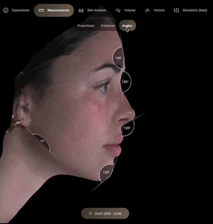 Side profile facial angle analysis from 3D imaging