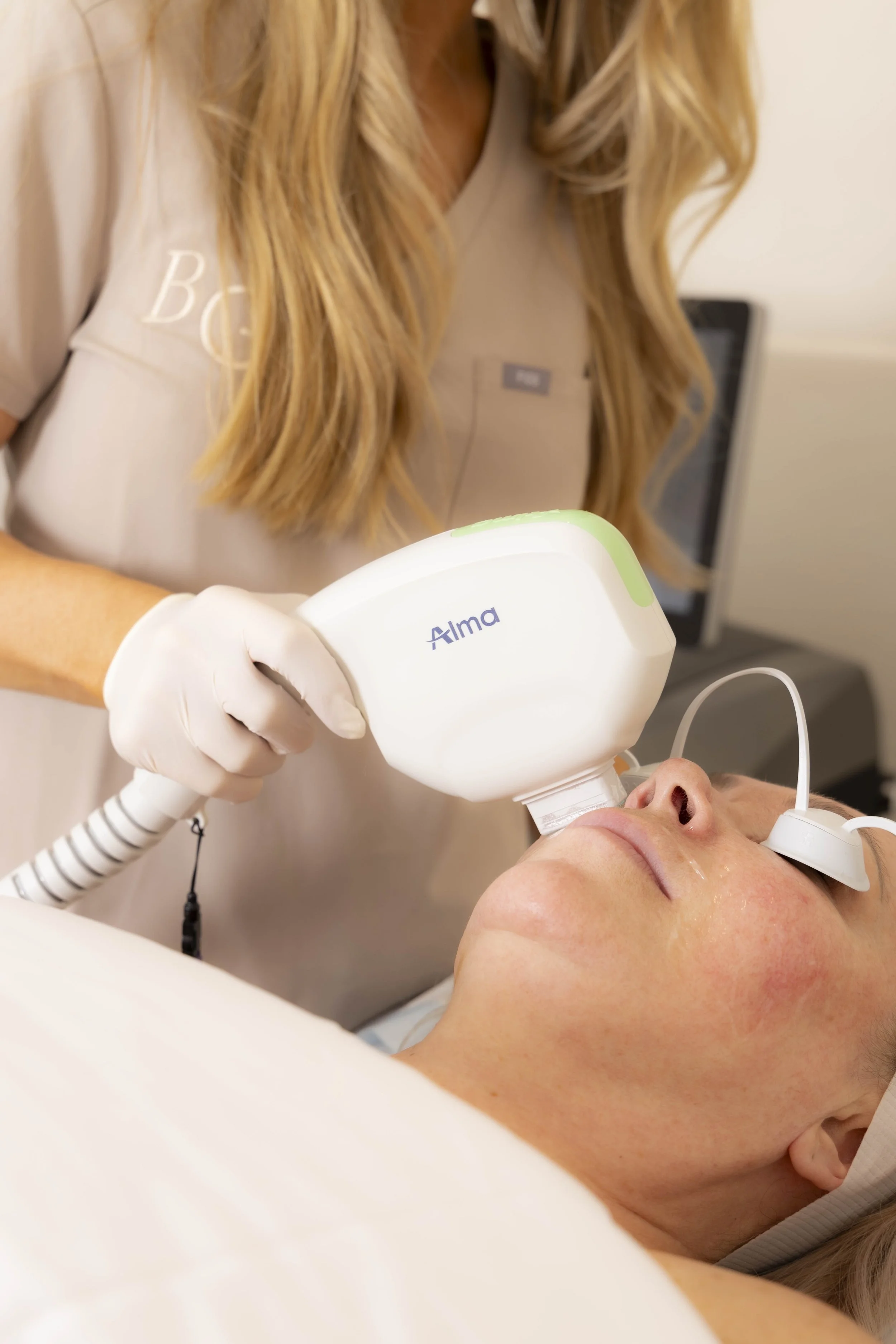 Skin rejuvenation and laser resurfacing results at BYGOLDEN Parkdale Melbourne