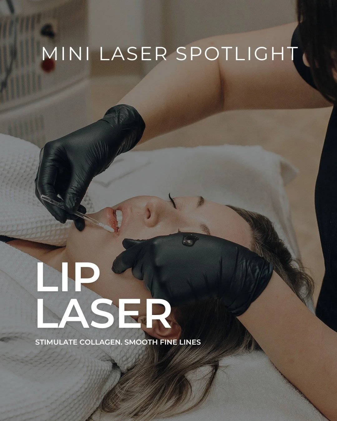 ✨ Our Mini Laser Treatments have been a client favorite since we launched them and for good reason. 🤍
At under $300, these quick, subtle refreshers are the perfect way to dip your toes into laser, maintain results between bigger sessions, or squeeze