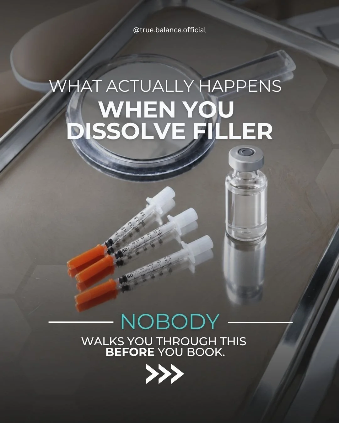 Thinking about dissolving your filler but nobody's told you what the appointment is actually like? Here's the whole thing.  The appointment itself is short. Hyaluronidase goes in where the filler is, small volumes across multiple points, and most peo