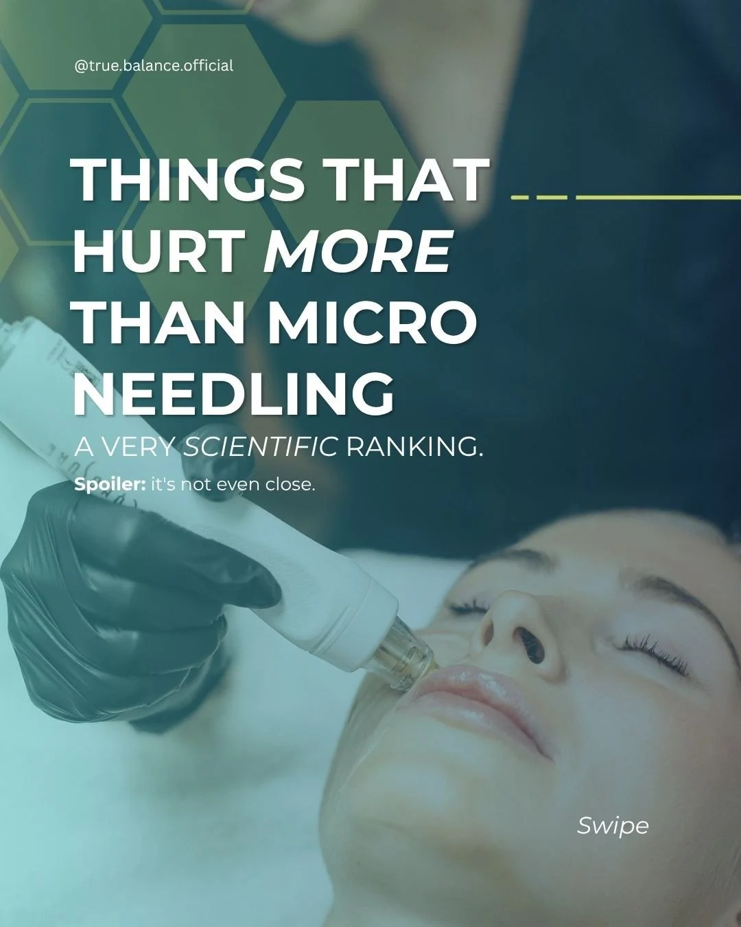 The word "microneedling" does a lot of unnecessary fear-mongering. 😅⁠
⁠
Turns out numbing cream is doing some heavy lifting, and most clients walk away surprised at how manageable it actually is.⁠
⁠
Individual experiences can vary, but for