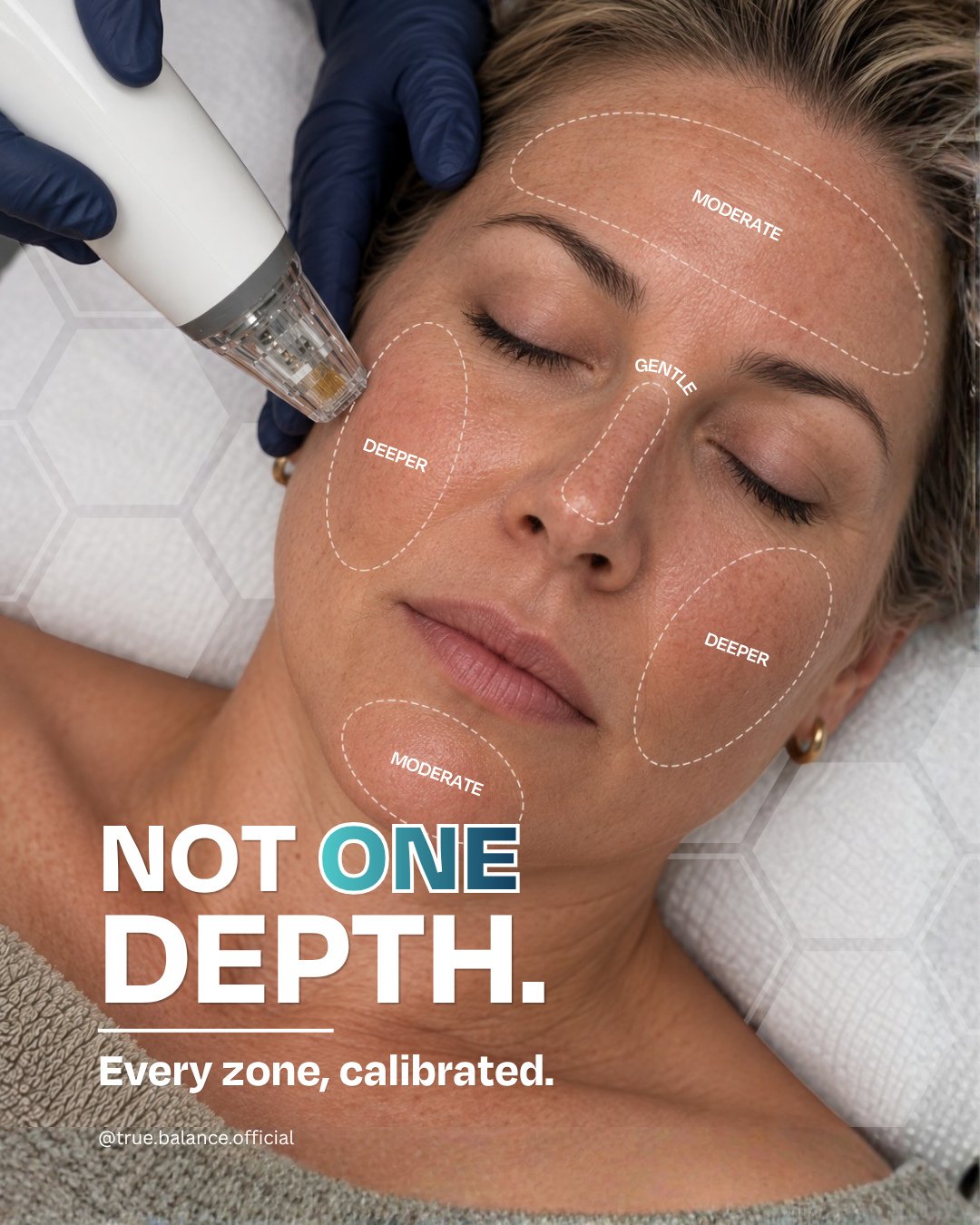 Your skin isn't the same thickness everywhere, so why would a needle be?⁠
⁠
Some areas can handle more intensity. Others need a lighter hand entirely. Getting that right, area by area, is less about the tool and more about the person holding it.⁠
⁠
T
