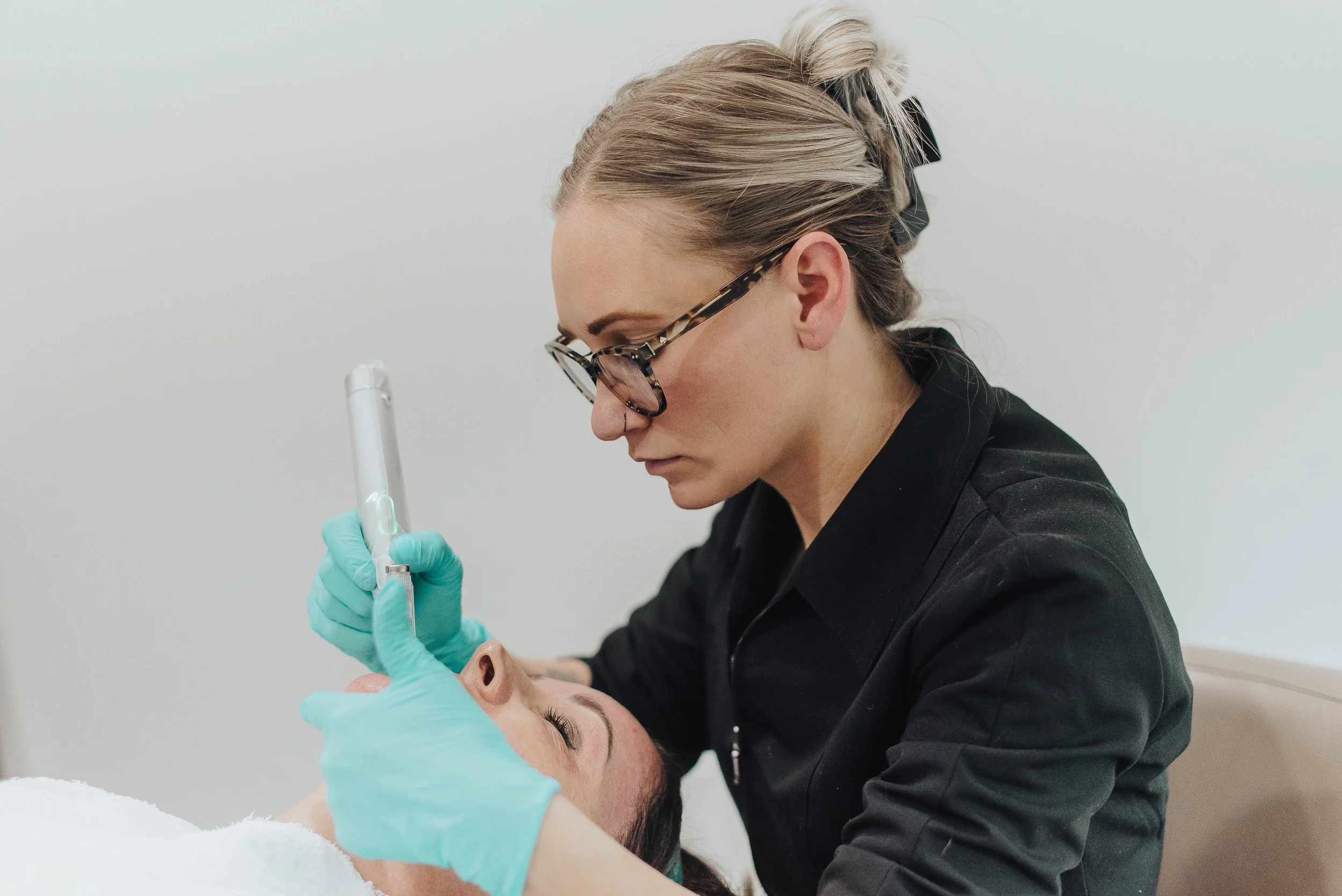 I8QmlDAMANDA.MICRONEEDLING-9784.jpg