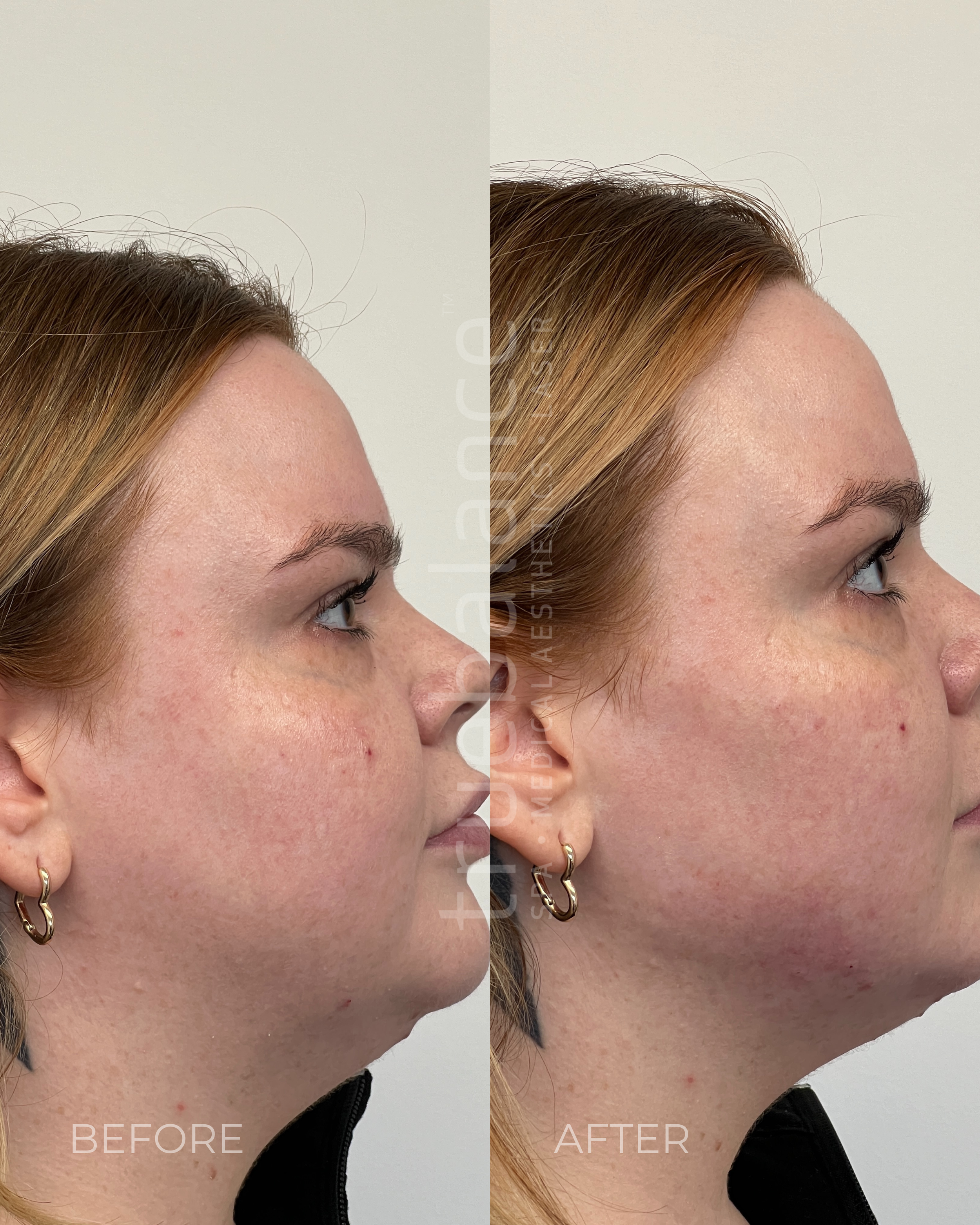 Website Before and Afters (11).png