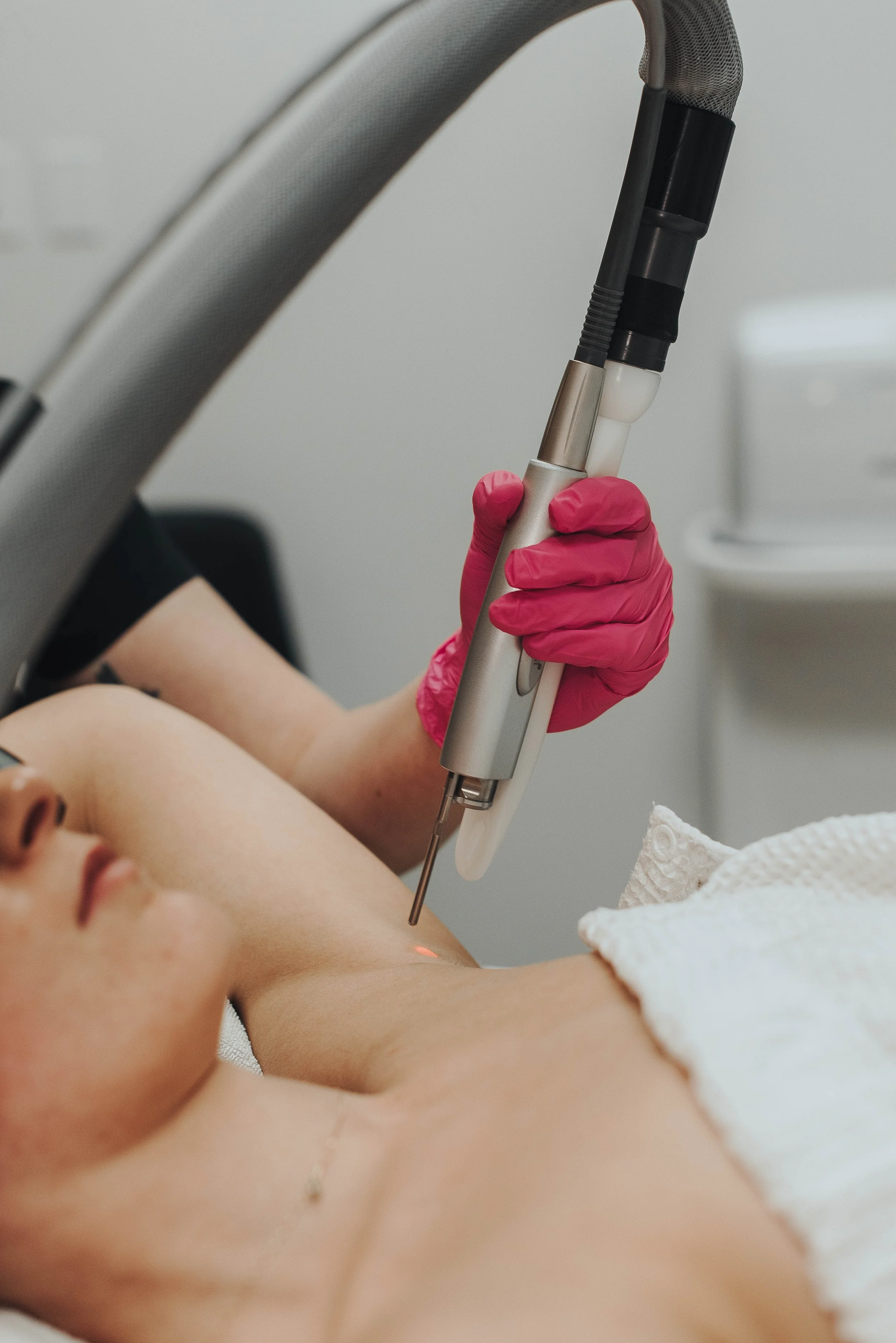 sam.laser.hair.removal.arm-3395.jpg