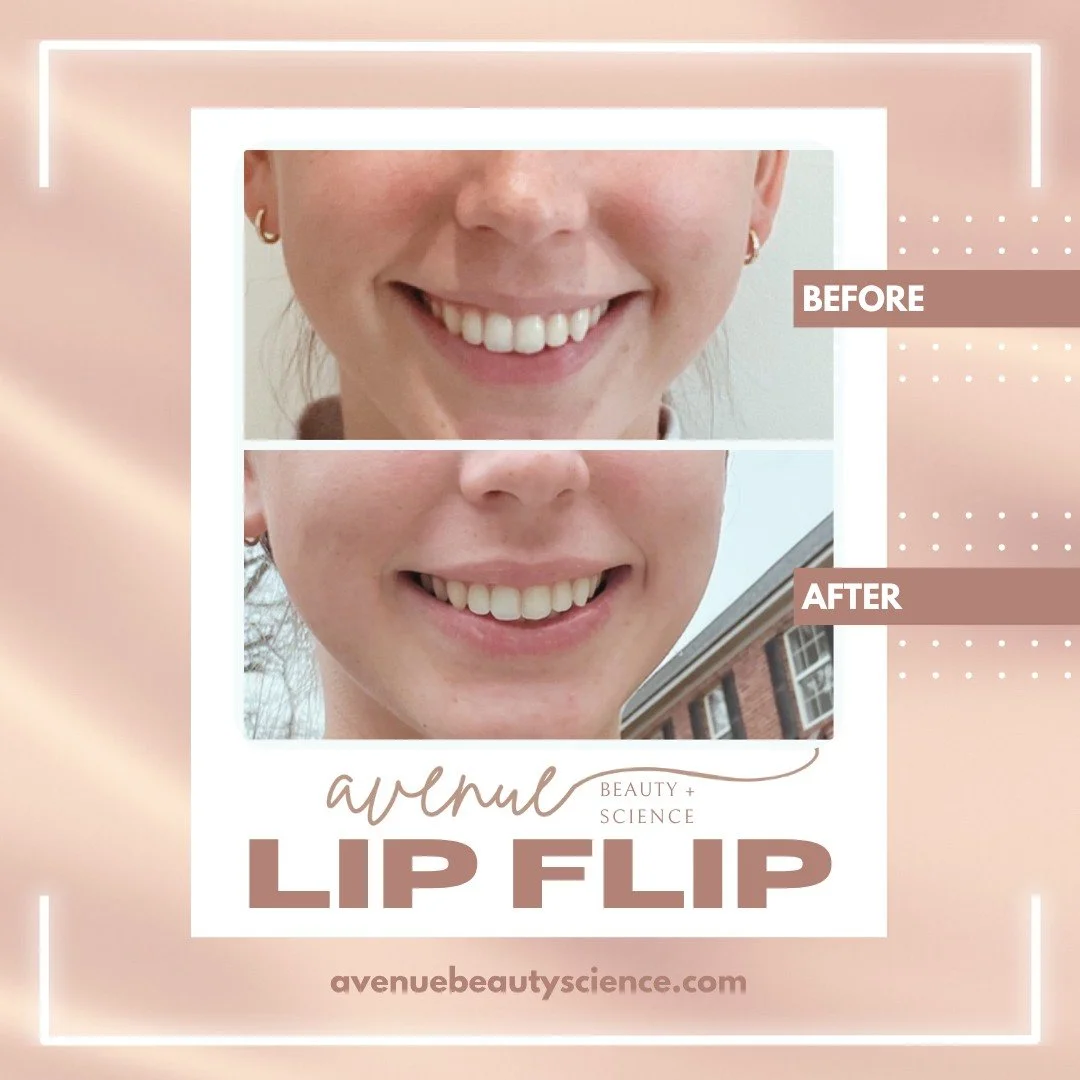 Treat yourself this holiday season! A lip flip is quick and inexpensive, plus it's a fun way to add a little plump to your pout.