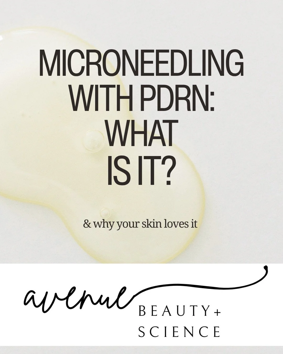 Good skin isn't luck. It's this. 🤍

Microneedling + PDRN at Avenue Beauty Science &mdash; two powerhouse treatments working together to rebuild your skin from the inside out. Less texture. More glow. Way more confidence.

DM us or tap the link in bi
