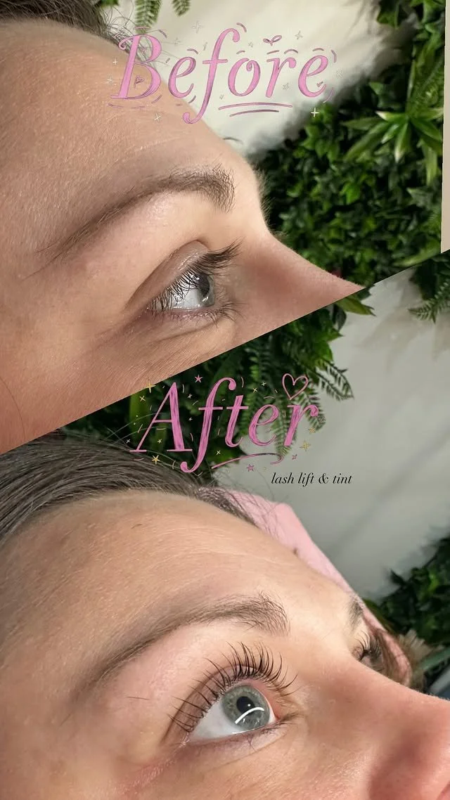 lift and tint before and after.jpg