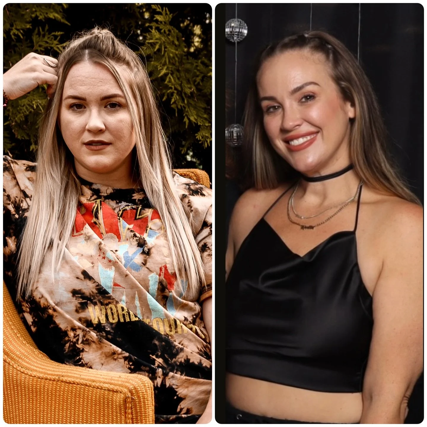 2.5 years ago I introduced tox and a great skincare routine into my life and I&rsquo;ve never been more thankful 🫶🏼

I have been incredibly self conscious about my skin since I was a teenager&mdash; redness, acne, dryness, etc. Truly one of my bigg