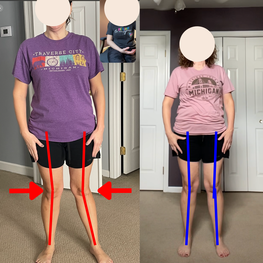 Aunt Patti Faceless Knee.PNG