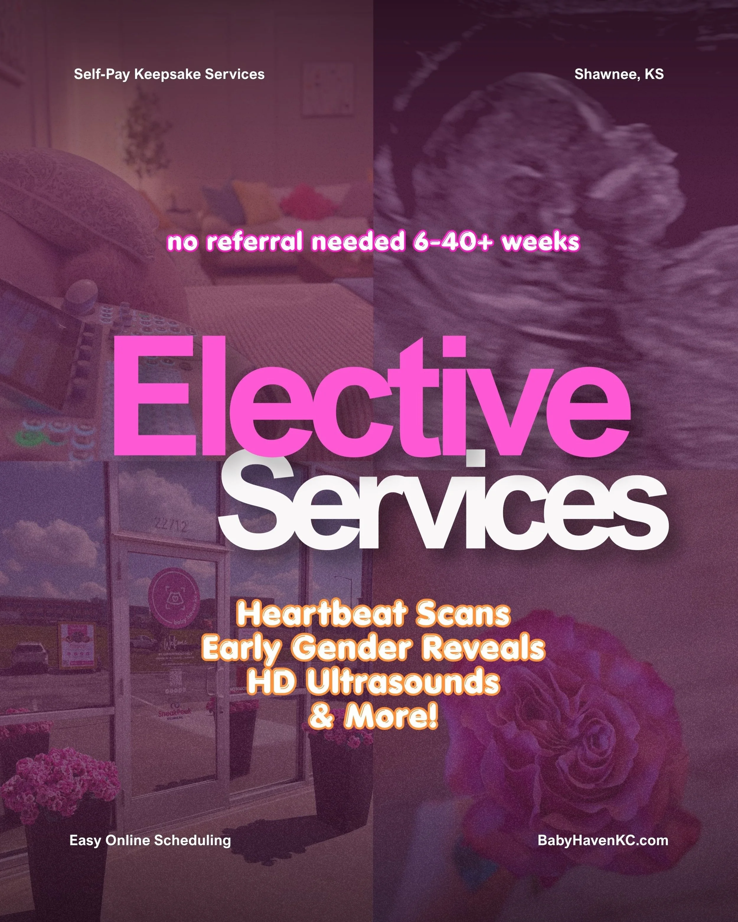 ✨ Your Baby Haven KC elective ultrasound questions, answered 🩷

If you&rsquo;re wondering &ldquo;when should I book?&rdquo; or &ldquo;what can I actually see?&rdquo;&hellip; we&rsquo;ve got you.

🤍 How early can I be seen?
We offer elective ultraso