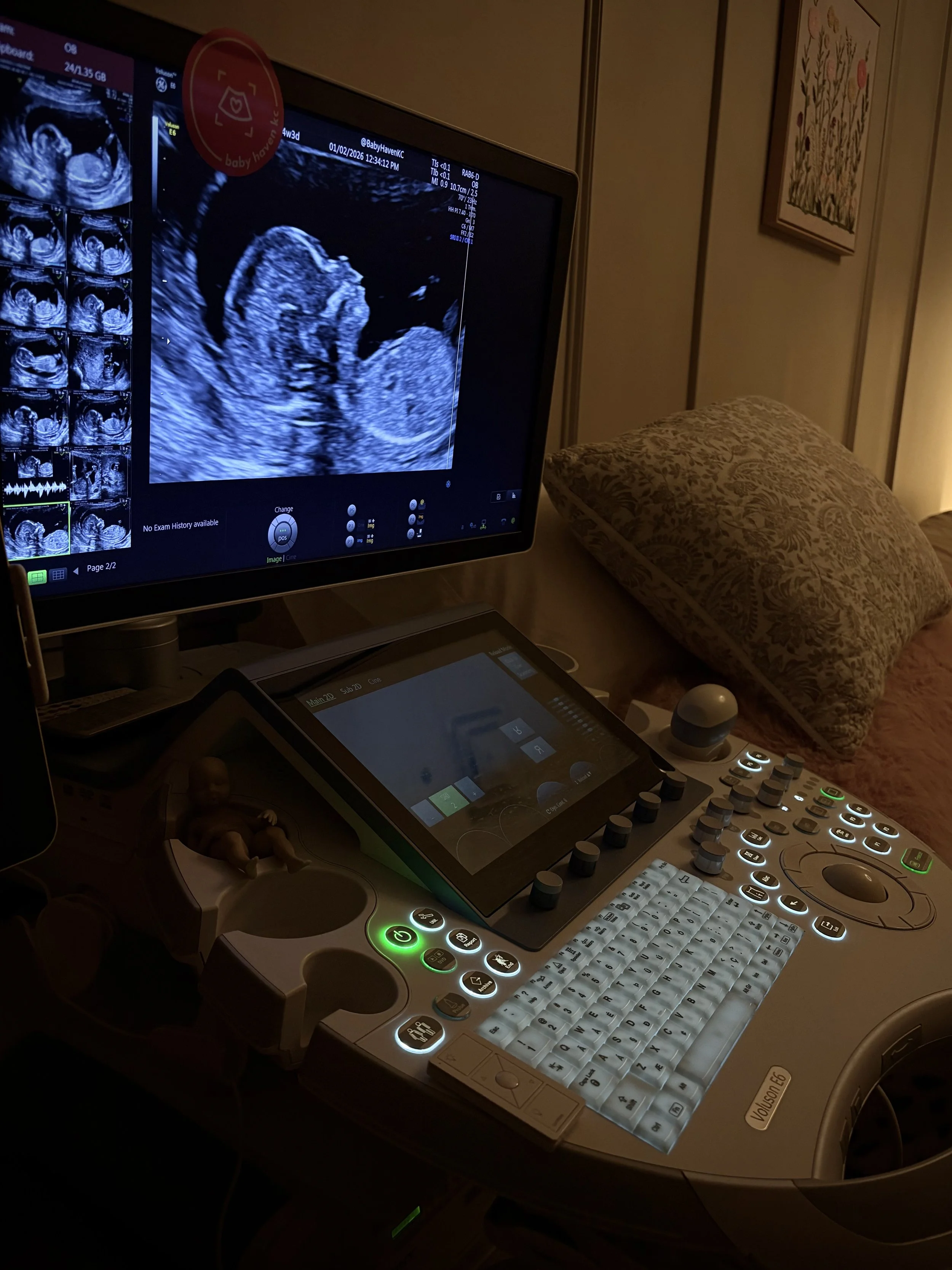 Ultrasound machine showing clarity of ultrasounds at Baby Haven KC @babyhavenkc