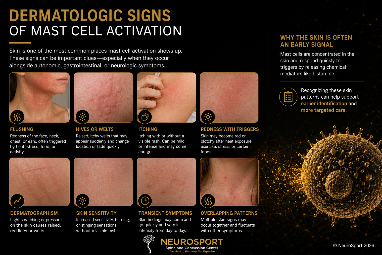 Images of skin changes seen in mast cell activation.