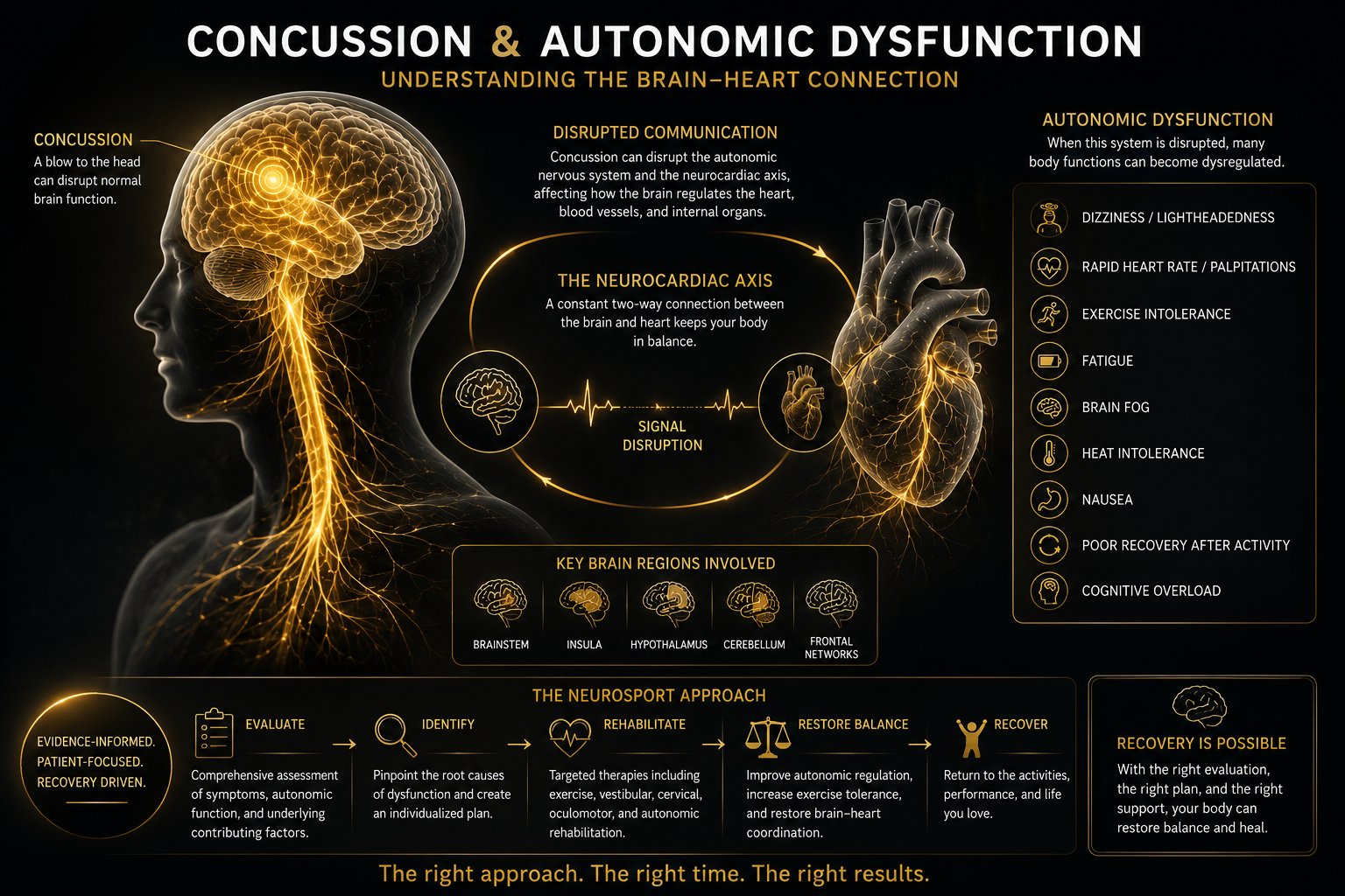 Understanding the brain heart connection in concussion