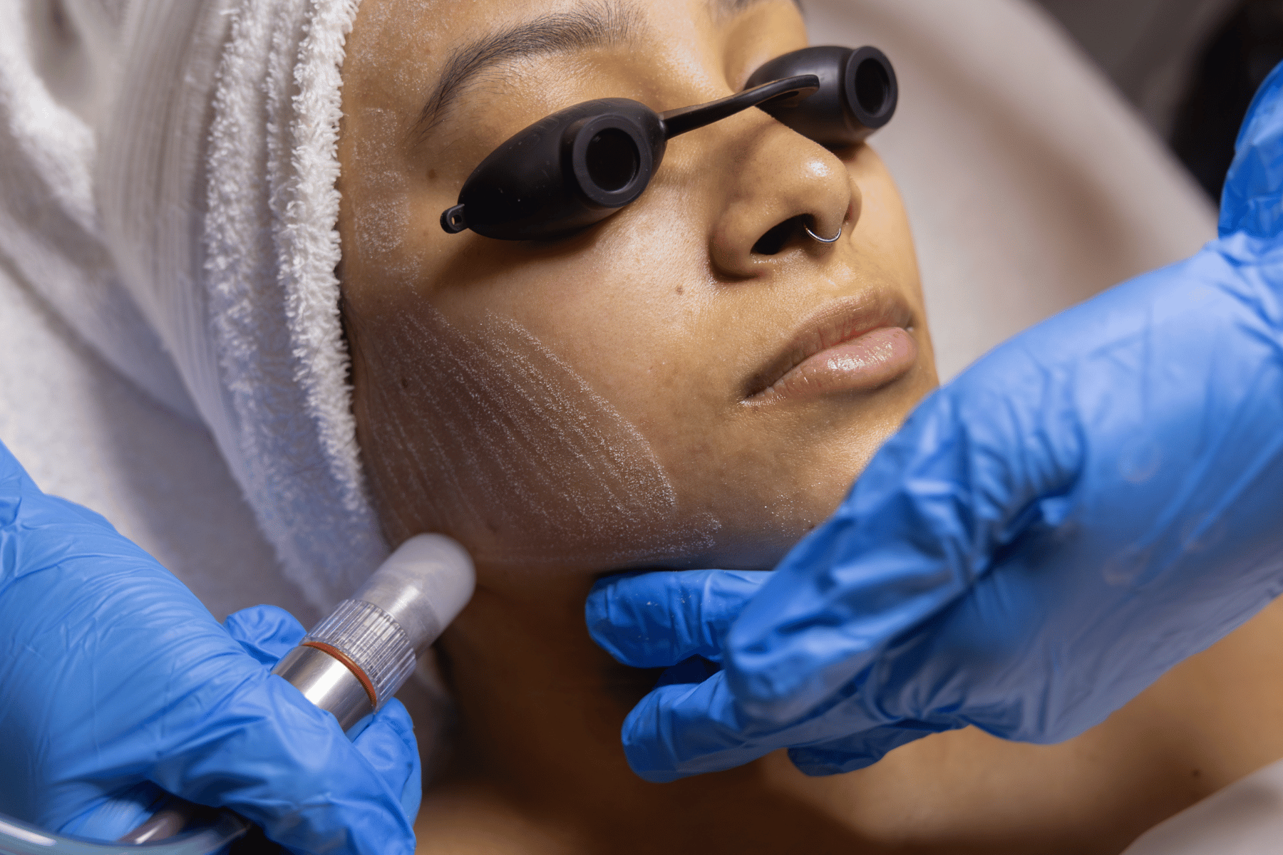 Microdermabrasion facial at Beauty By Biba