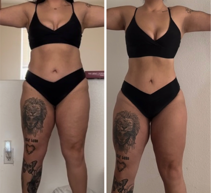 Image of Alexis's transformation with ALIGN Wellness.