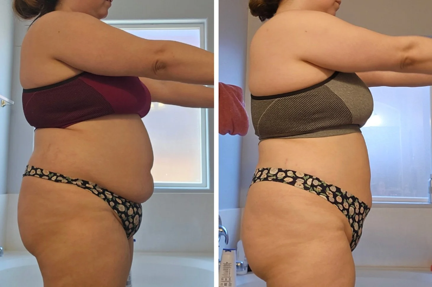 Side view before and after photo of Alysha.