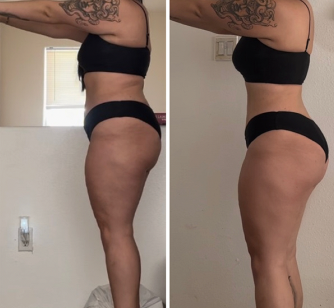 Image of Alexis's transformation with ALIGN Wellness.