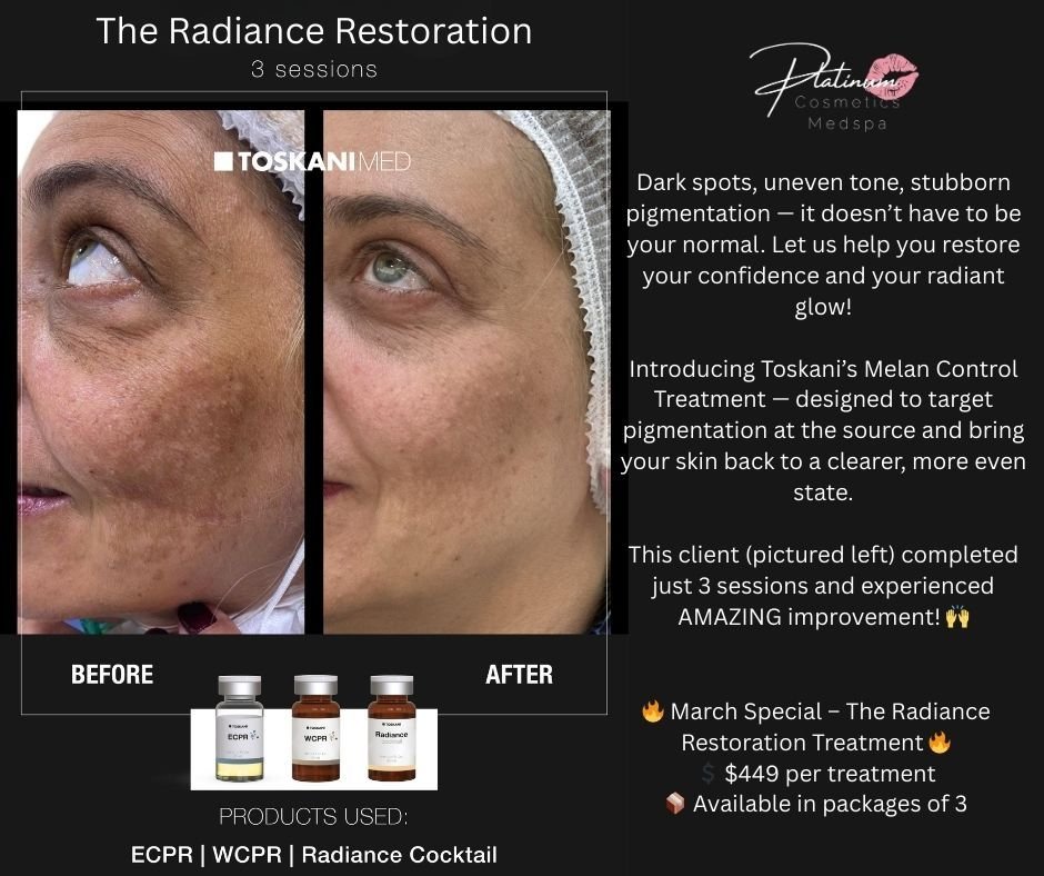 ✨🌟 Struggling with Pigment You Hate? Let&rsquo;s Fix That. 🌟✨

Dark spots, uneven tone, stubborn pigmentation &mdash; it doesn&rsquo;t have to be your normal. Let us help you restore your confidence and your radiant glow!

Introducing Toskani&rsquo