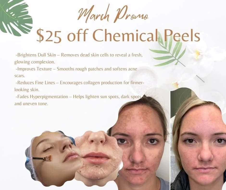 Glow deeper ✨

Take $25 OFF your Chemical Peel for a limited time 🙌

Brighten dull skin, smooth texture, fade dark spots, and reset your glow just in time for the season change.

If your skin needs a refresh, this is your sign.

Limited promo spots 