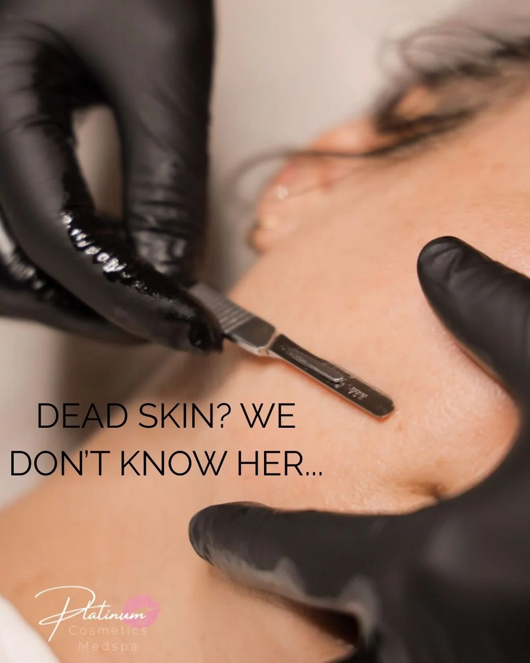 Ready for your smoothest skin yet? ✨ Dermaplaning gently removes dead skin + peach fuzz to reveal a brighter, softer, more radiant glow&mdash;aka your makeup will apply like a dream and your skincare will work even better 💁&zwj;♀️

Say goodbye to du