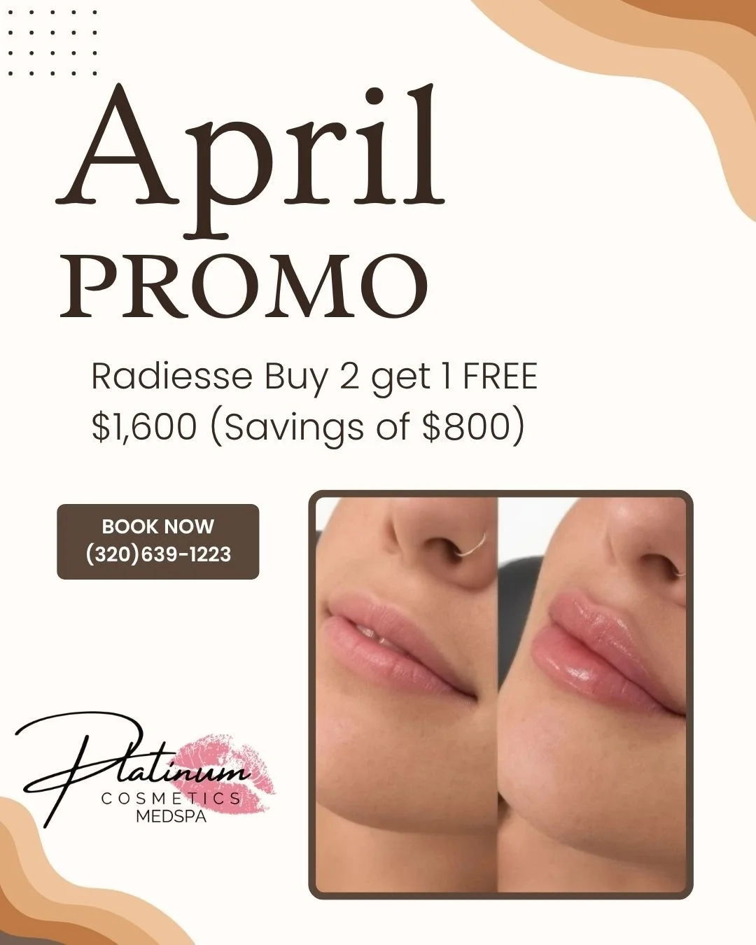 BUY 2, GET 1 FREE ✨
Radiesse &bull; $1,600 (Save $800)

Lift. Contour. Restore.
Don&rsquo;t miss this&mdash;book now 💖