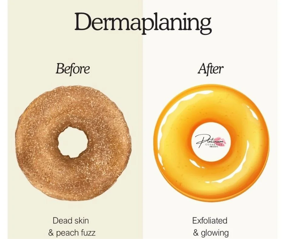 ✨ Say hello to smoother, brighter skin ✨

Dermaplaning is the ultimate glow-up treatment&mdash;removing dead skin cells and peach fuzz to instantly reveal a softer, more radiant complexion. Your skincare products absorb better, your makeup goes on fl